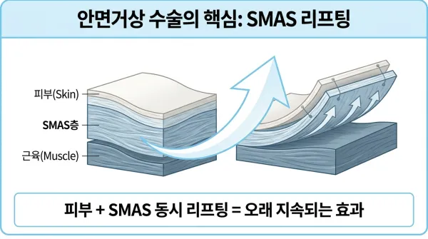 안면거상 수술 완벽 가이드: 성형외과 전문의가 알려주는 모든 것