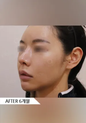 After