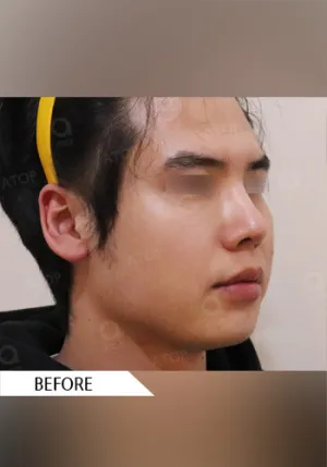 Before