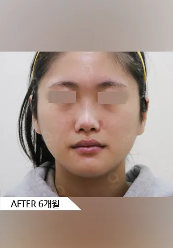 After