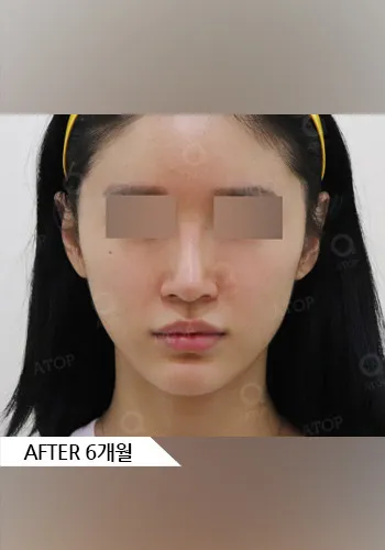 After