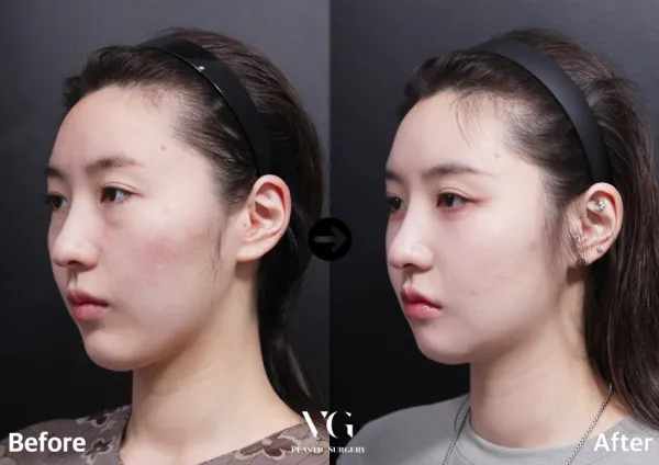 After