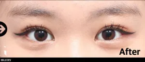 After