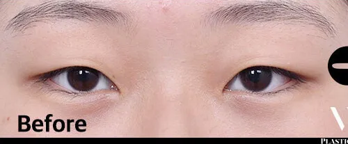 Before