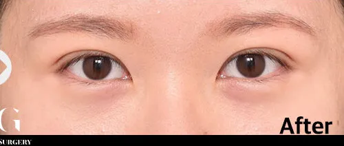 After