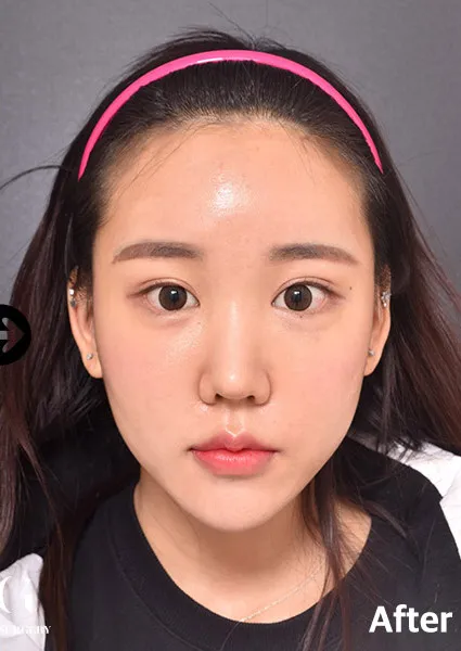 After