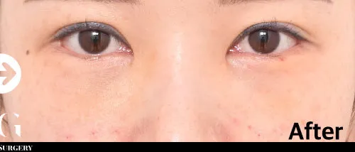 After