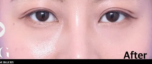 After