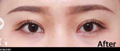 After