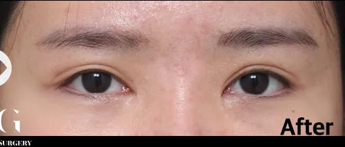 After