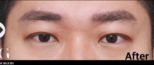 After