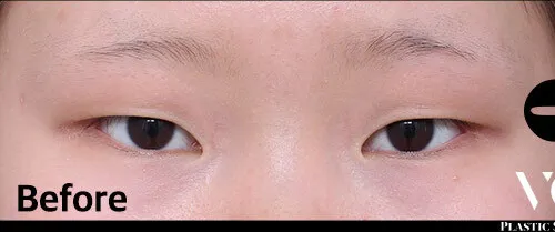 Before