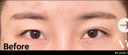 Before