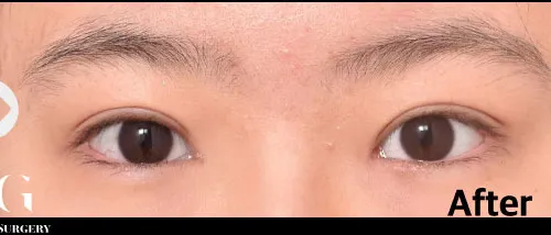 After