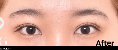 After