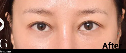 After