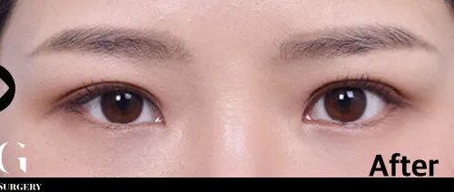 After
