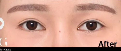 After