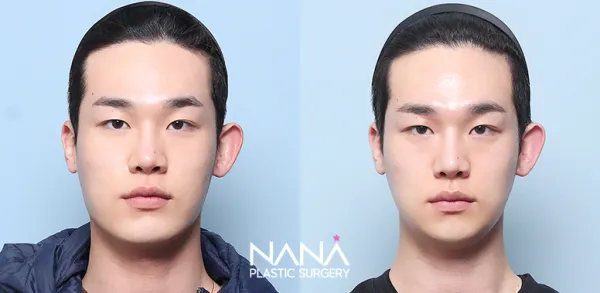 Before