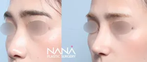 Before