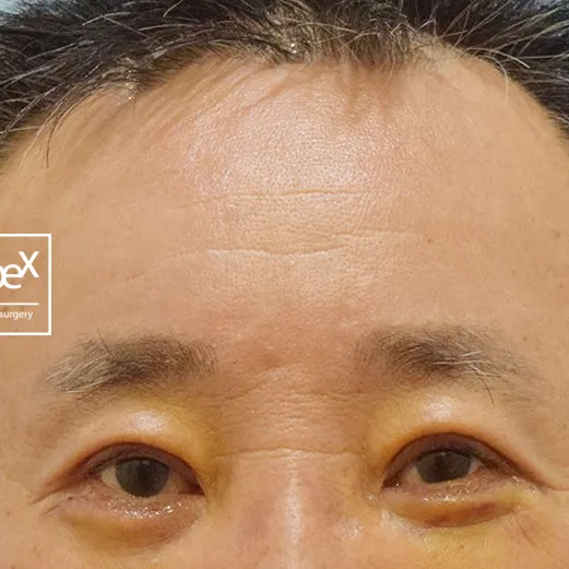 After