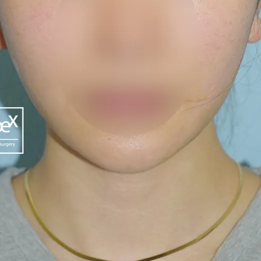 After