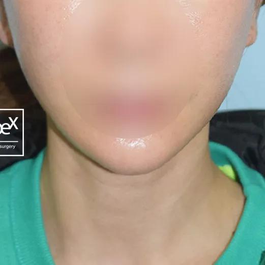 After