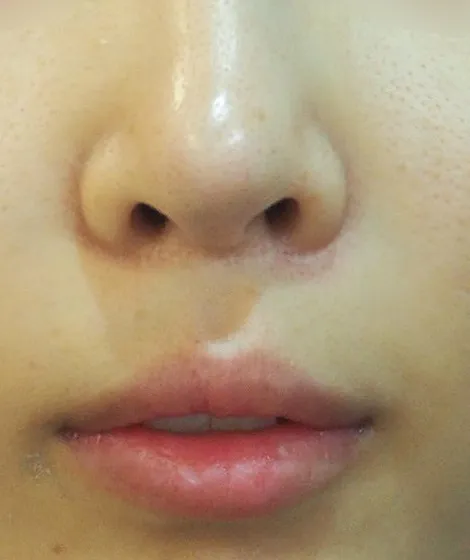 After