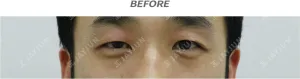 Before