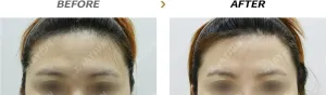 Before