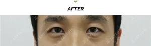 After