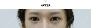 After