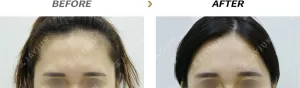 Before