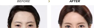 Before