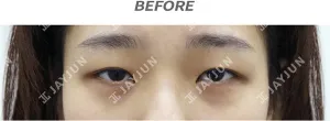 Before