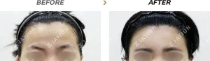 Before