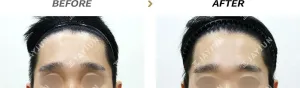 Before
