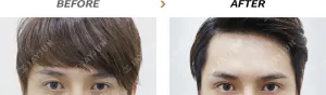 Before