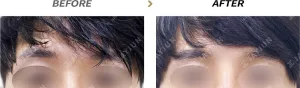 Before