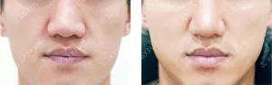 After