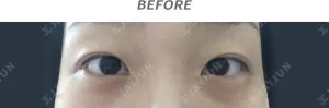 Before