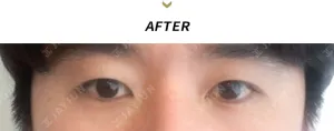 After