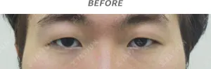 Before