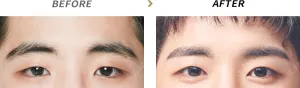 Before