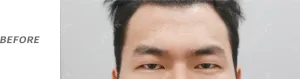 Before