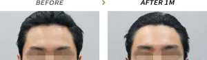 Before