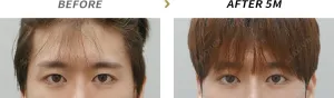 Before