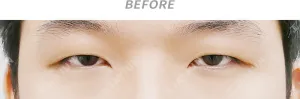 Before