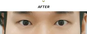 After