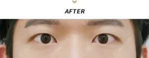 After